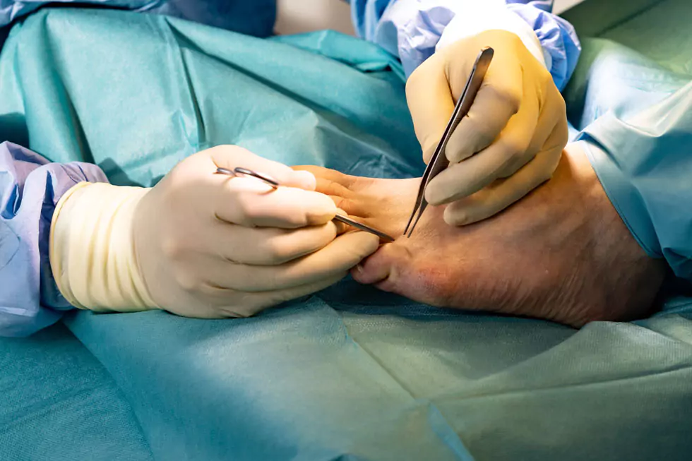 Arzt Operiert den Fuß einer Patientin (Nahaufnahme)
